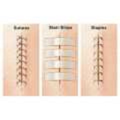 Set 3 vỉ 30 miếng dán thay chỉ khâu da 3M Steri-strip™ R1546 – Size 6mm x 100mm | Sản xuất tại Mỹ