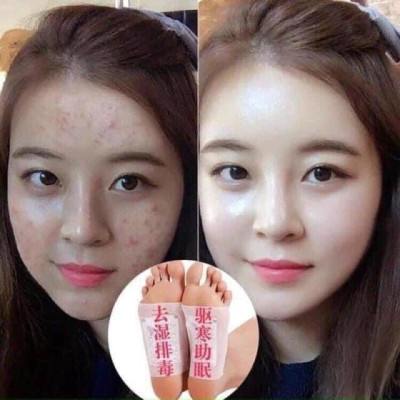 HỘP 50 miếng dán chân thải độc ,các chất cặn bã trong cơ thể qua gan bàn chân