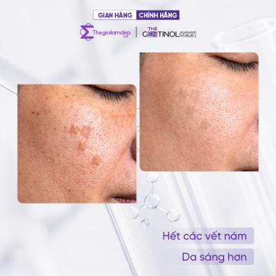 Kem White-on tái sinh tế bào, khôi phục sự cân bằng da The Gentinol 0221 50g