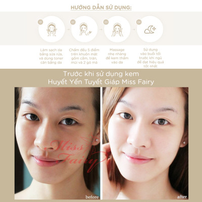 KEM MISSFAIRY HUYẾT YẾN - TUYẾN GIÁP 12G - DƯỠNG TRẮNG - CẤP ẨM - XOÁ THÂM NÁM