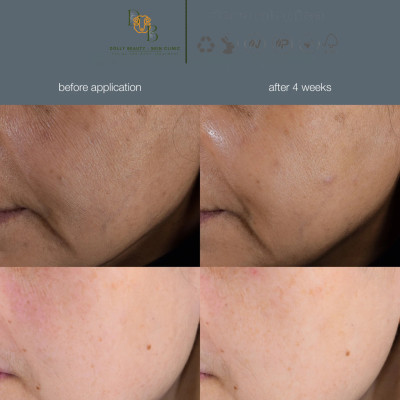 Tinh chất dưỡng da SMART RESPONSE SERUM của Dermalogica  - Dolly Beauty