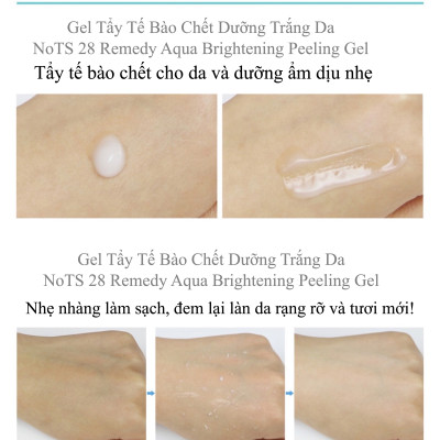 TẨY TẾ BÀO CHẾT NOTS 28 REMEDY QUA BRIGHTENING PEELING GEL