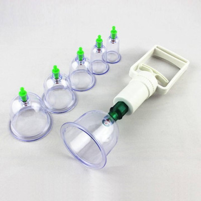 Bộ Dụng Cụ Giác Hơi 12 Ly Không Dùng Lửa Tiện Dụng