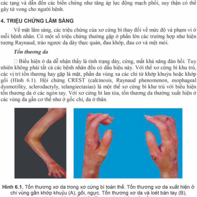 Sách - Bệnh học Nội khoa 2025 (Trọn bộ)