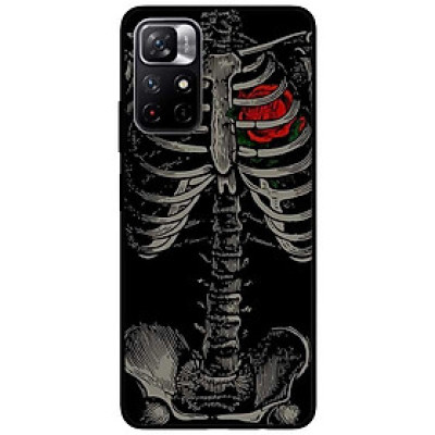 Ốp lưng dành cho Xiaomi Redmi Note 11 5G - Redmi Note 11T - Redmi Note 11S - Hoa Hồng Đỏ Xương